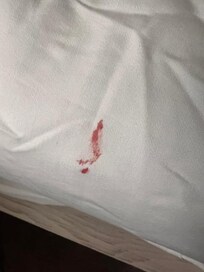 blood stain on sheets