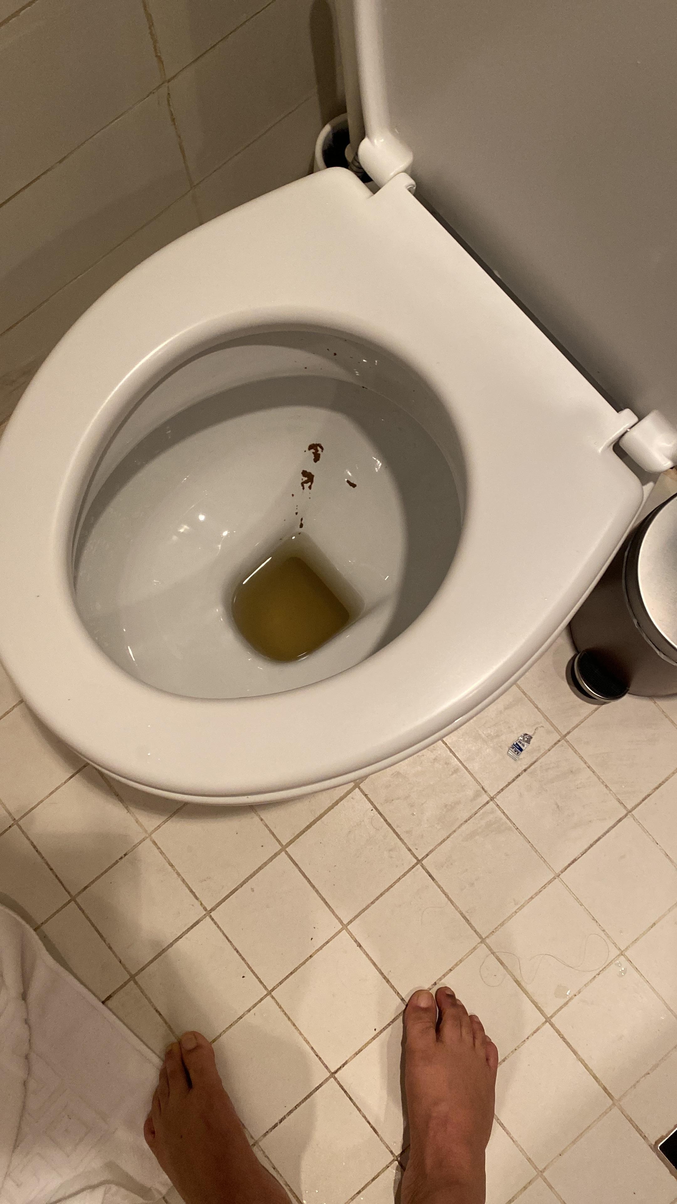 Unhealthy toilet bowl