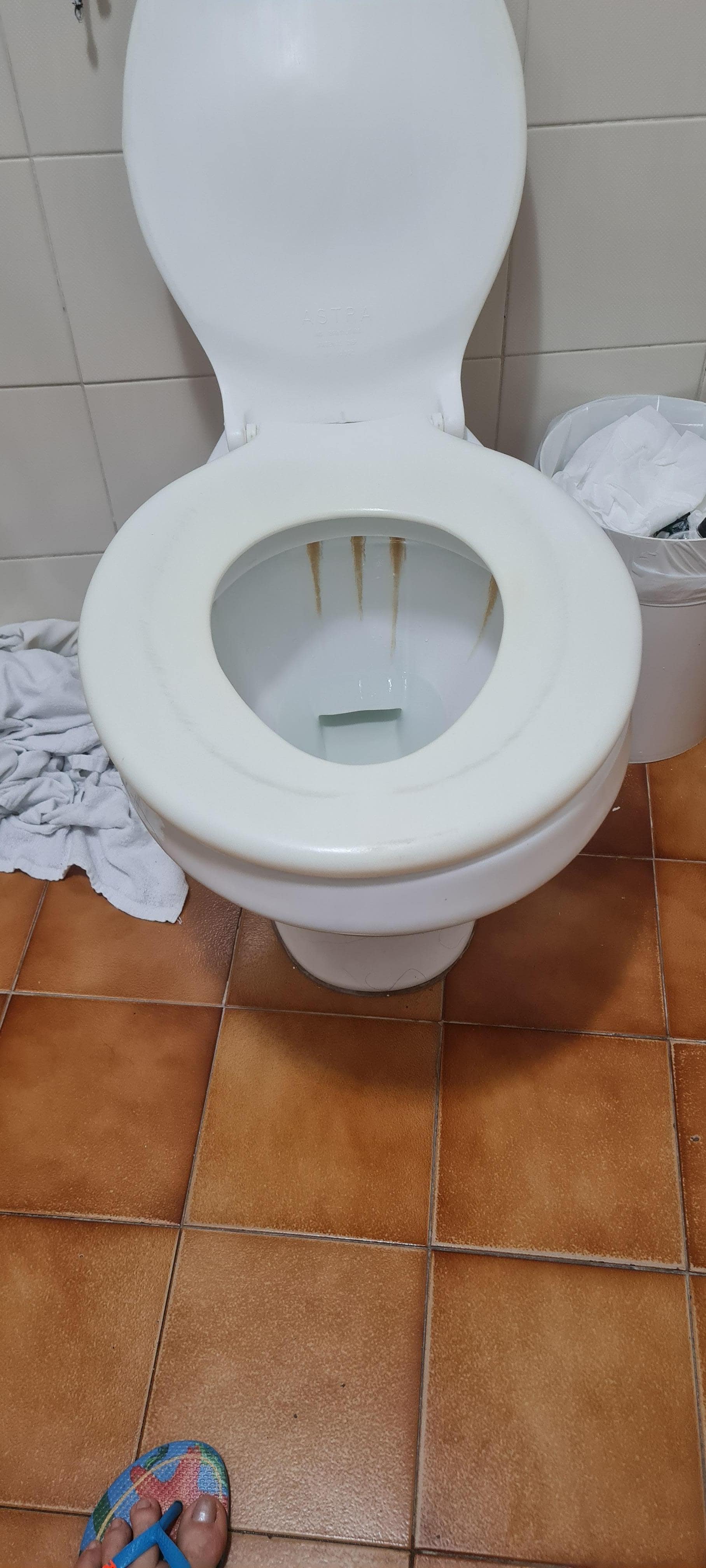 Vaso sanitário sujo.