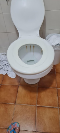Vaso sanitário sujo.