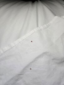 Blood stains