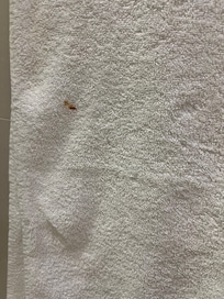 Stain on bath towel