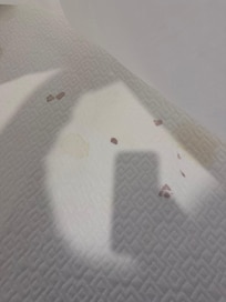 Blood and urine stained mattresses