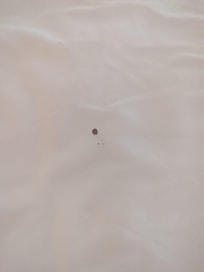 Bed bug blood-stained bed sheeets at Cormoran Hotel, Tulum