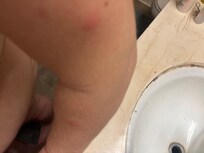 On the last two days we were given departure gifts bug bites