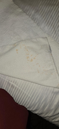 Stained towel upon walking in our room after check in.