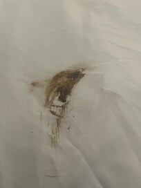 Soiled poop sheets in attic room bed