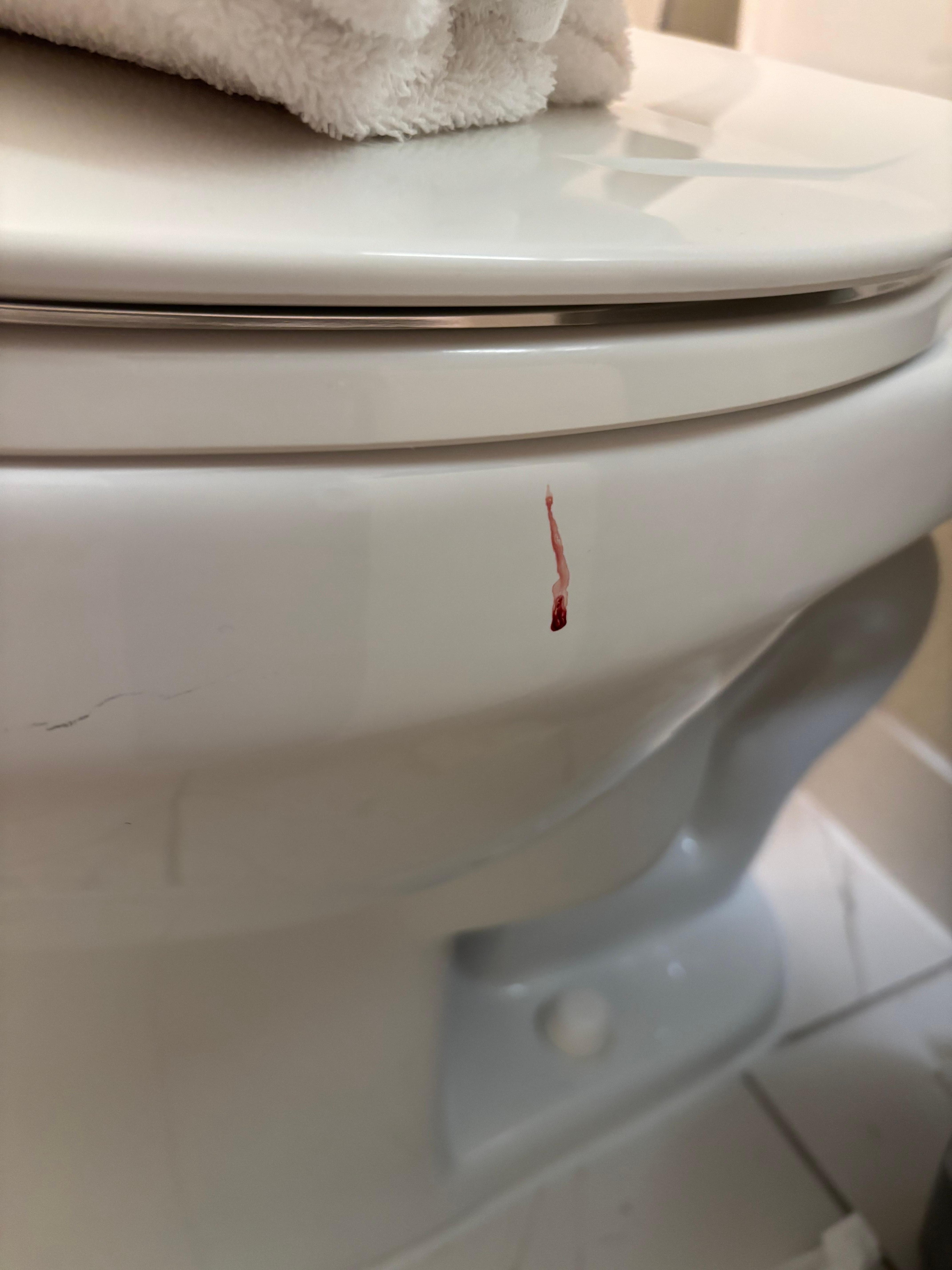 Blood on toilet