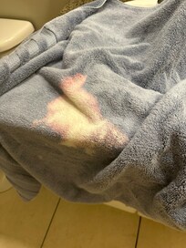 Bleach Towel Gross