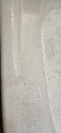 Pubic hair