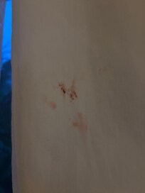 Blood or something else, stains on curtains in 2 rooms