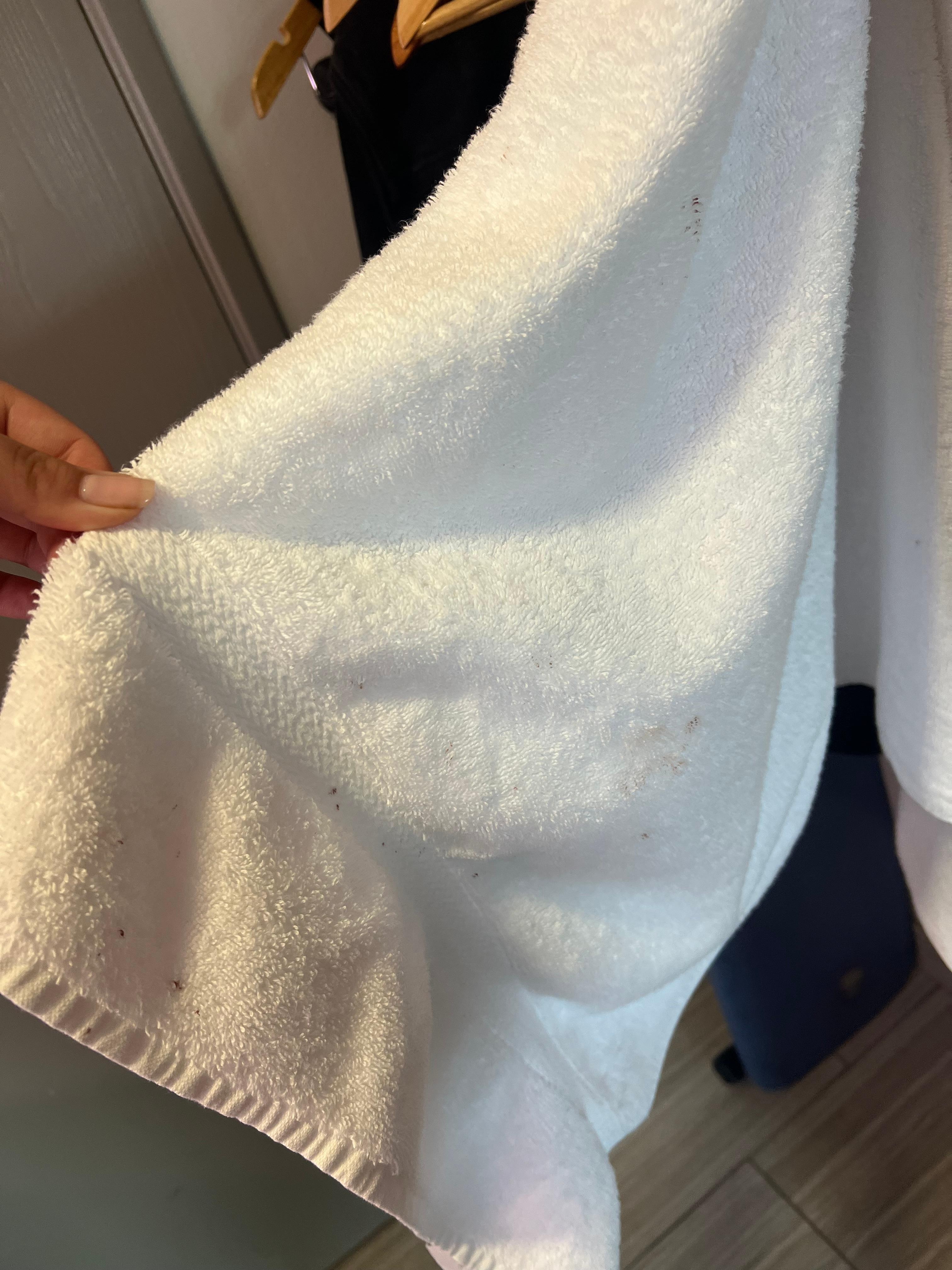 Towels with questionable stains. Looked like blood.