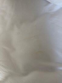 Stain on bed