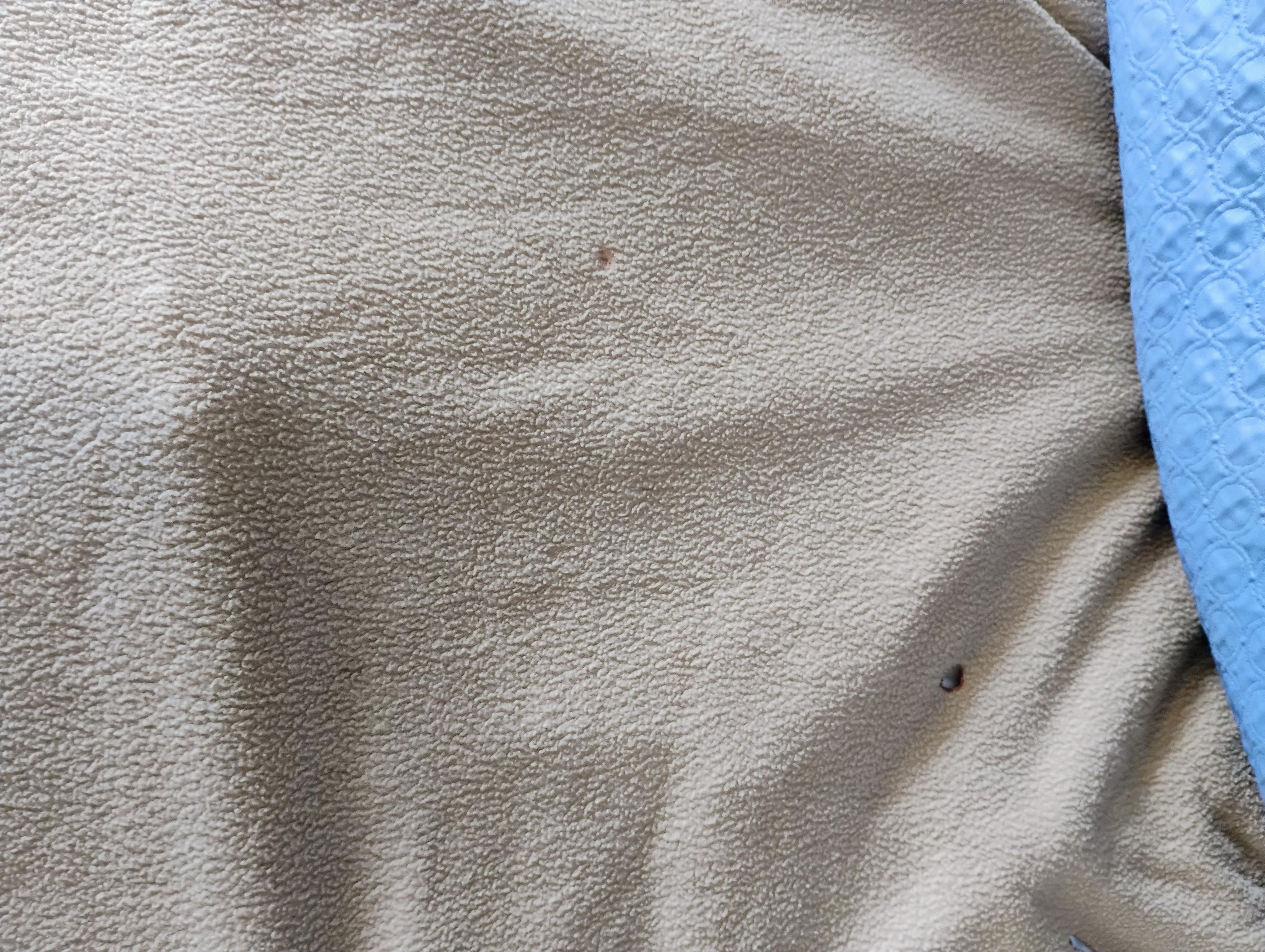 Burns in the sheets 