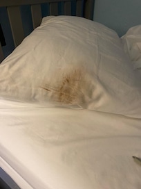 Stains in bedroom.