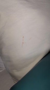 Blood stains on pillow case