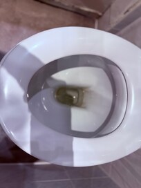 toilet is old and dirty looking.