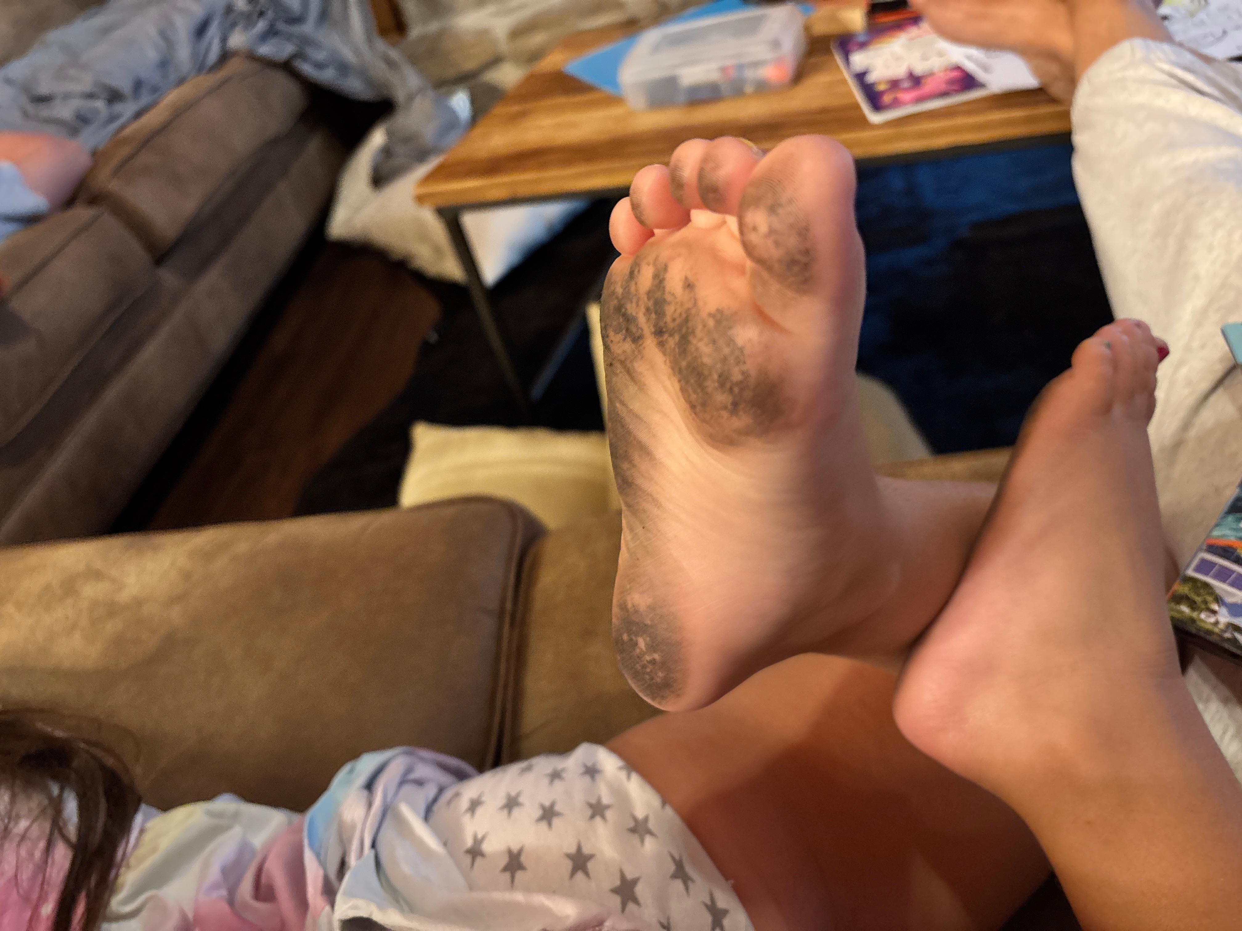 My daughter feet after the first day there.  