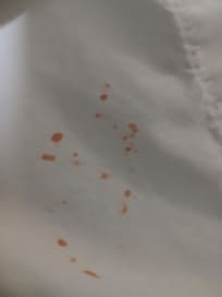 Stains on sheets