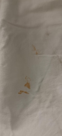 Stains on the bedding