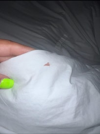 Old blood on sheets.