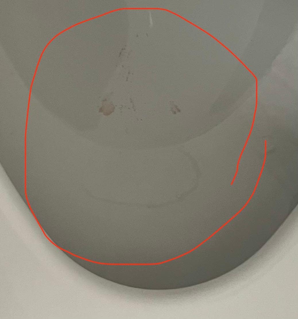 Pink fingí and dark marks inside 