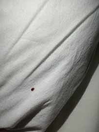 My friend here left me with red welts all over my body.