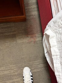 Room #2 identical mystery stain