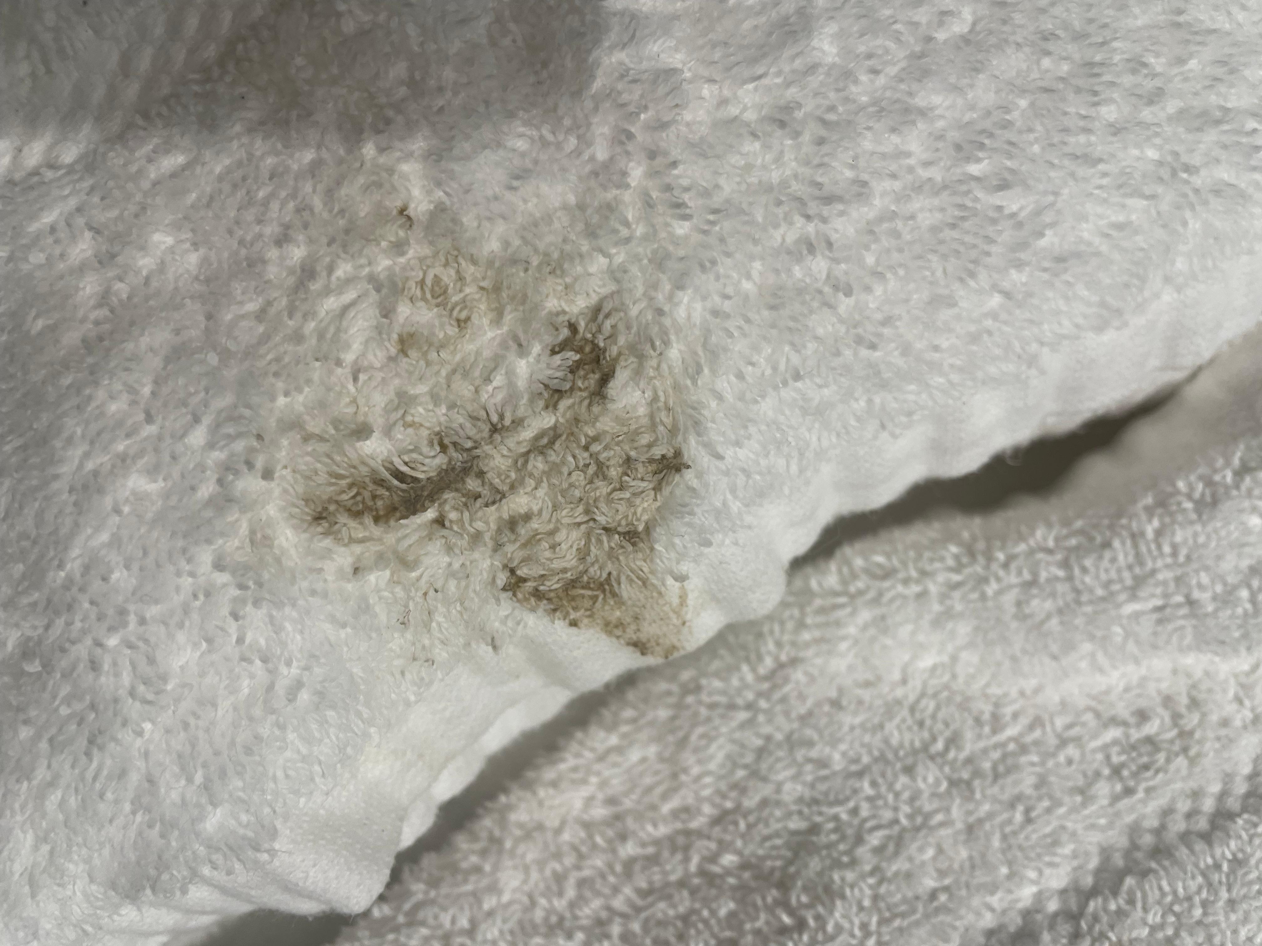 Dirty towels in our room . Unfortunately you didn’t as the towel was rolled. 