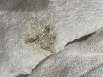 Dirty towels in our room . Unfortunately you didn’t as the towel was rolled.