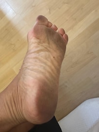 My feet after showering and walking around the room. Had to wash them again Nd immediately pit my shoes on