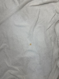 Blood stains in the towels