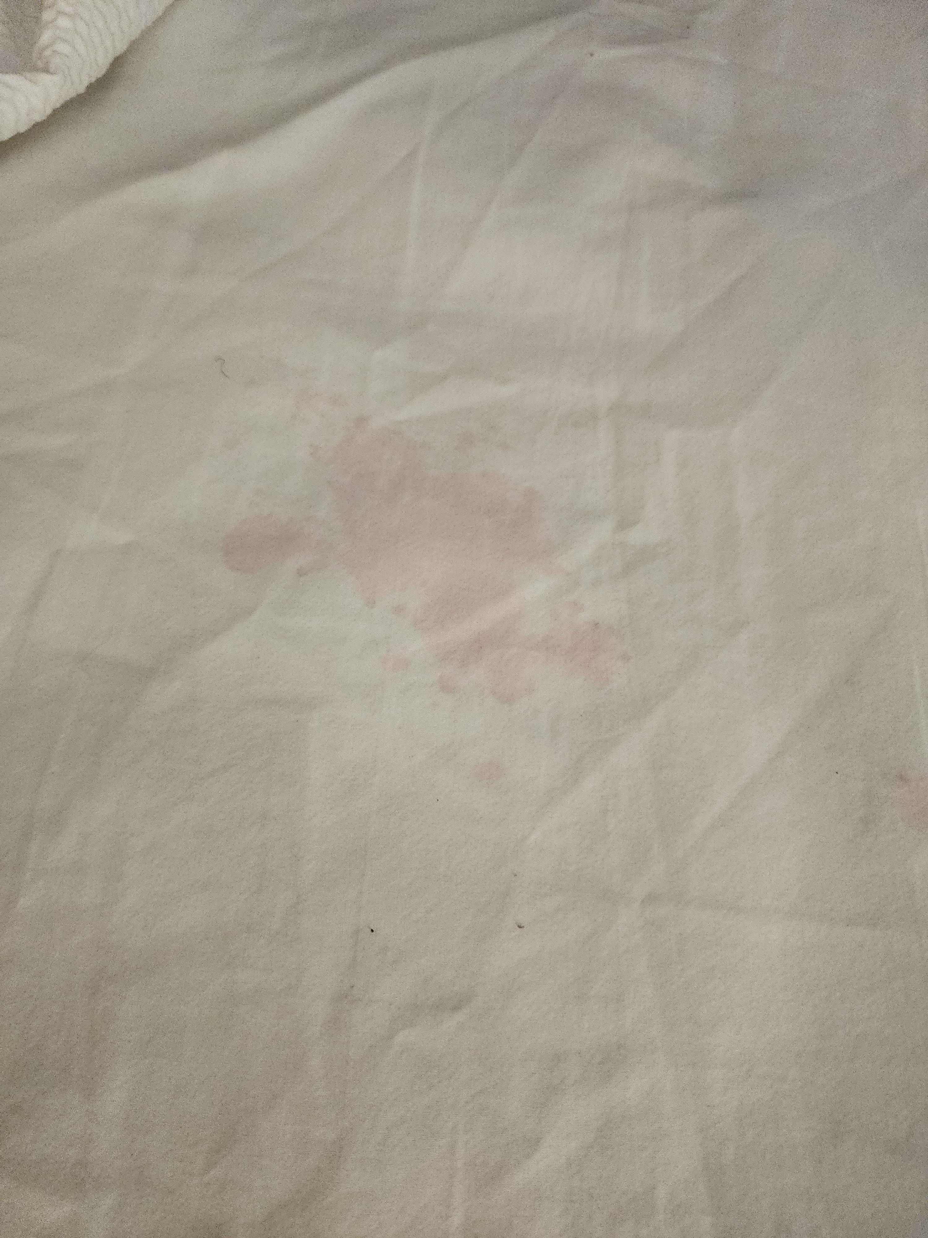Stained and dirty sheets