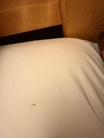 Dried booger and hair