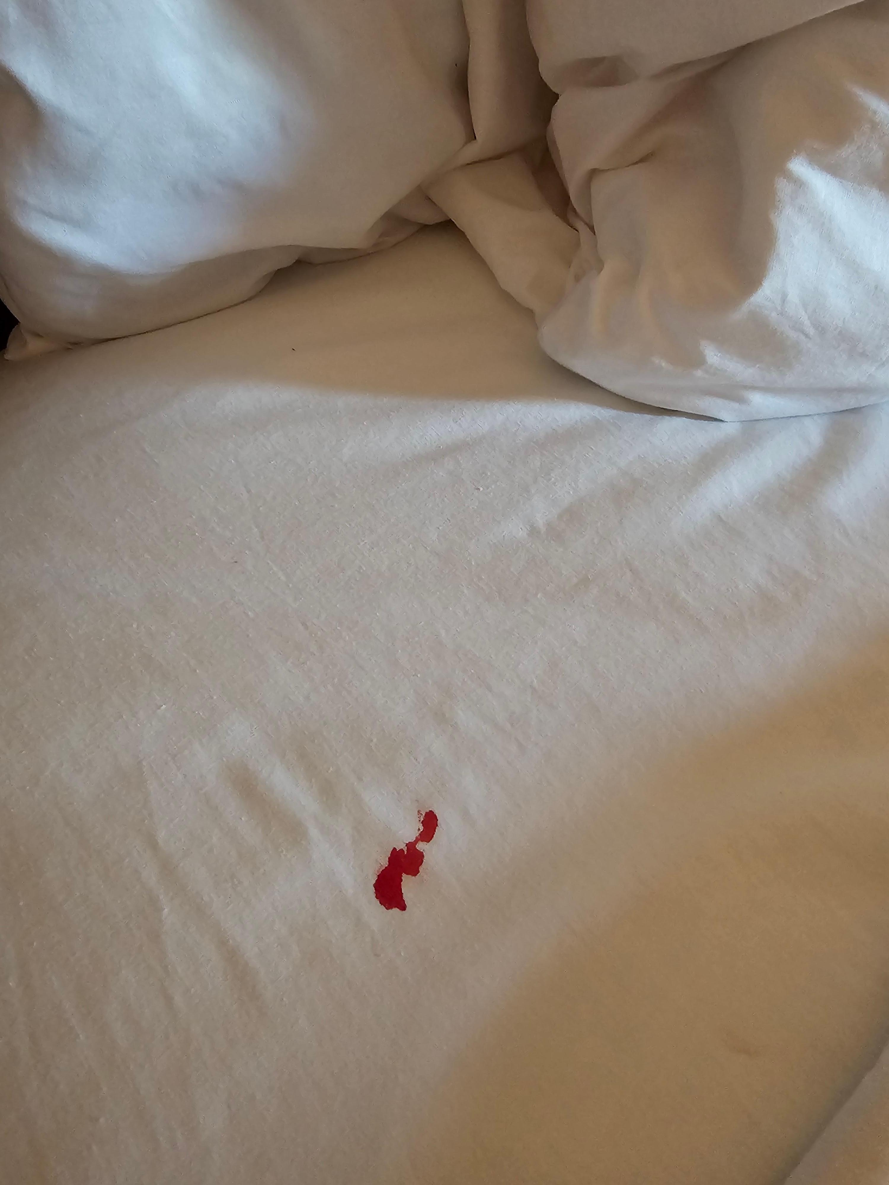 Bloody sheet
