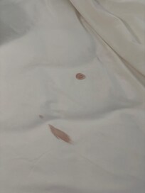 Blood stains that had not been washed