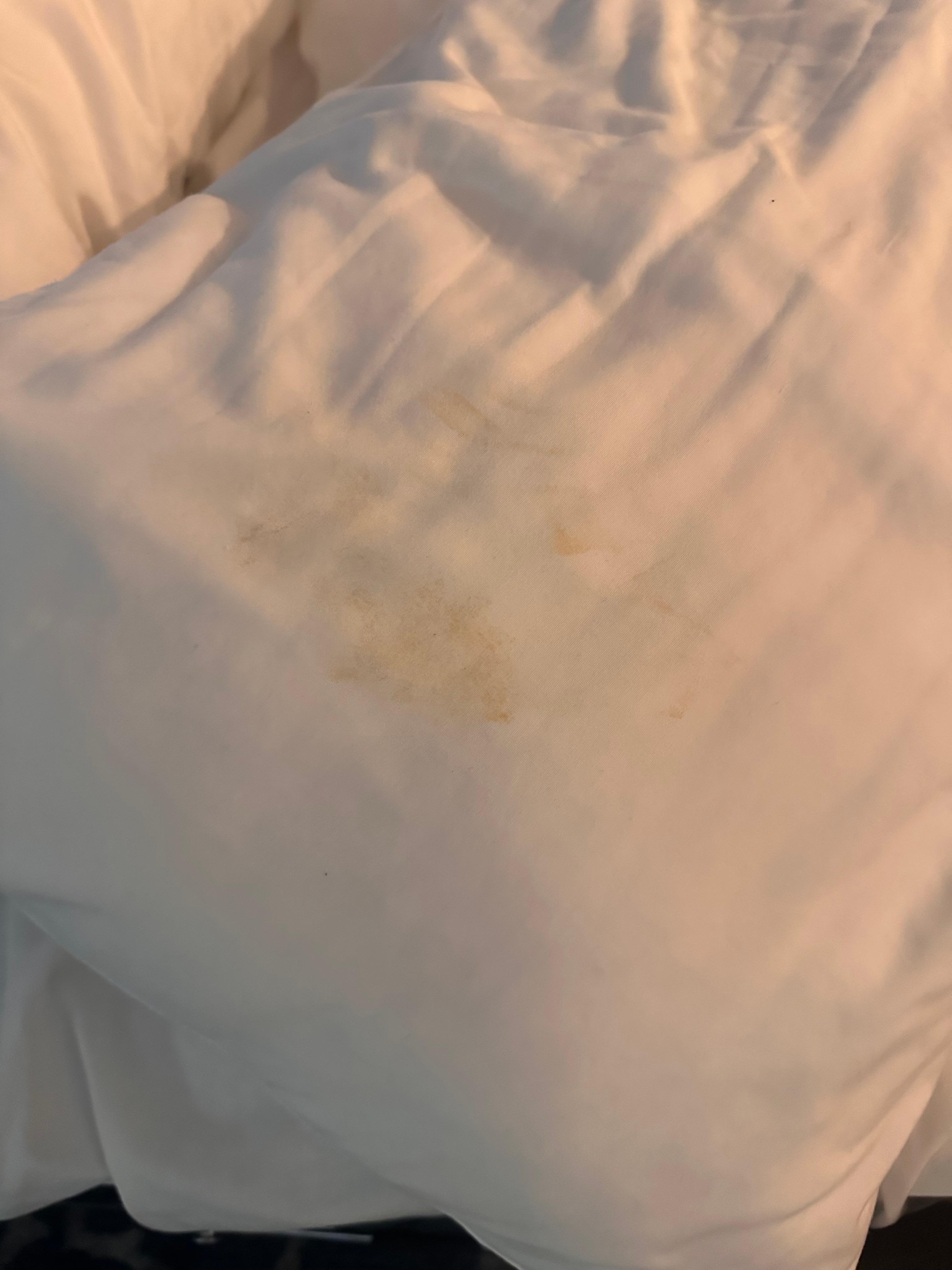 Stains