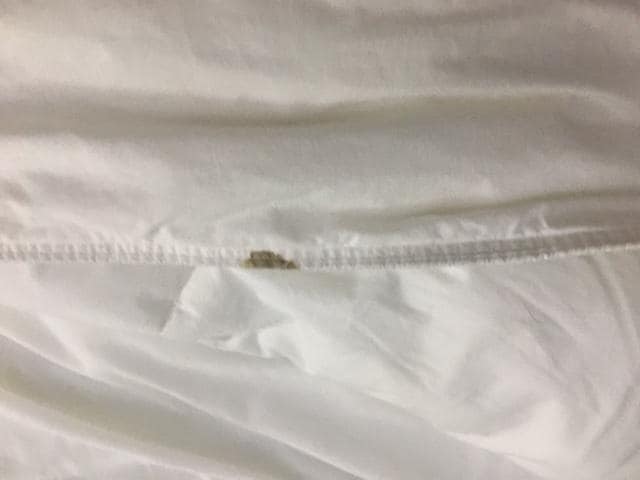 Room #1 Hairs in bedding