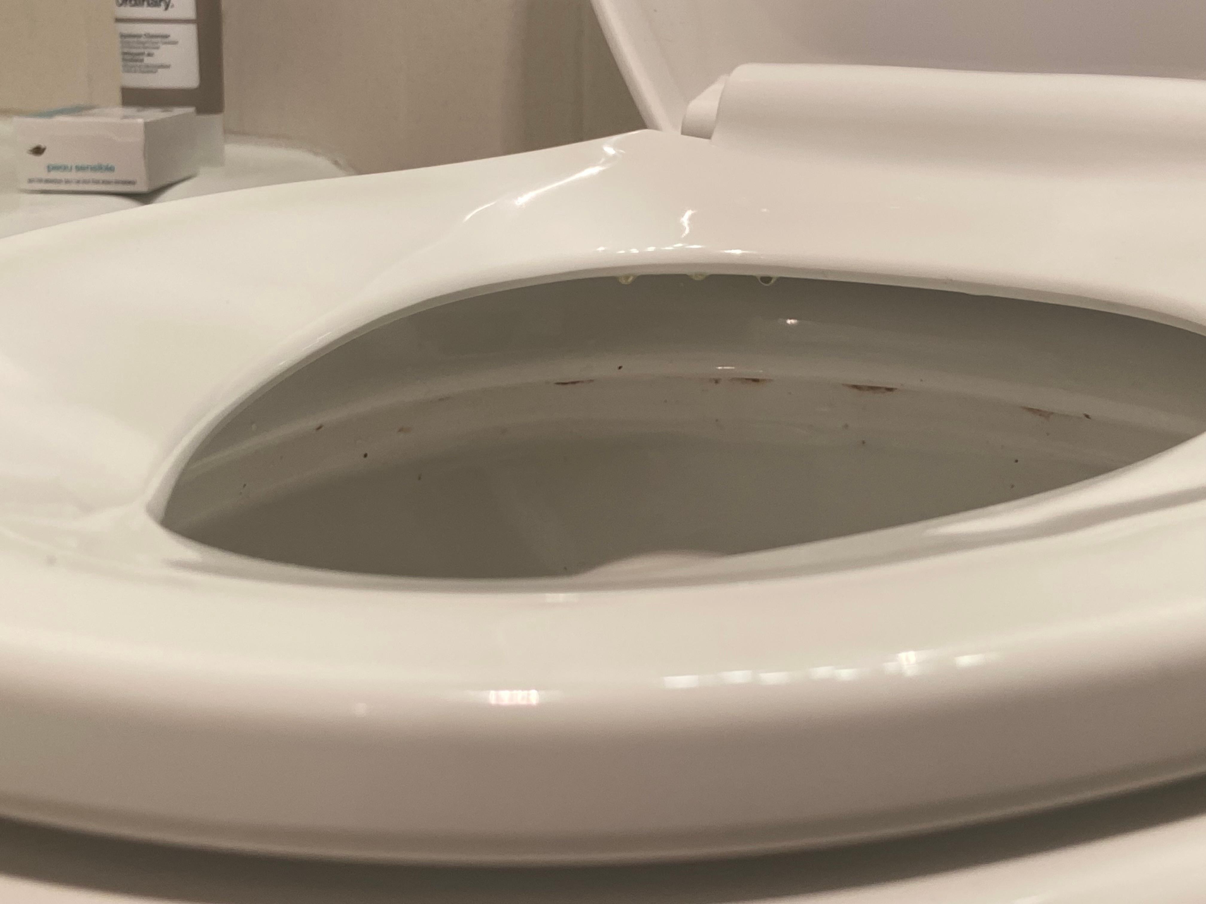 Dirty toilet 