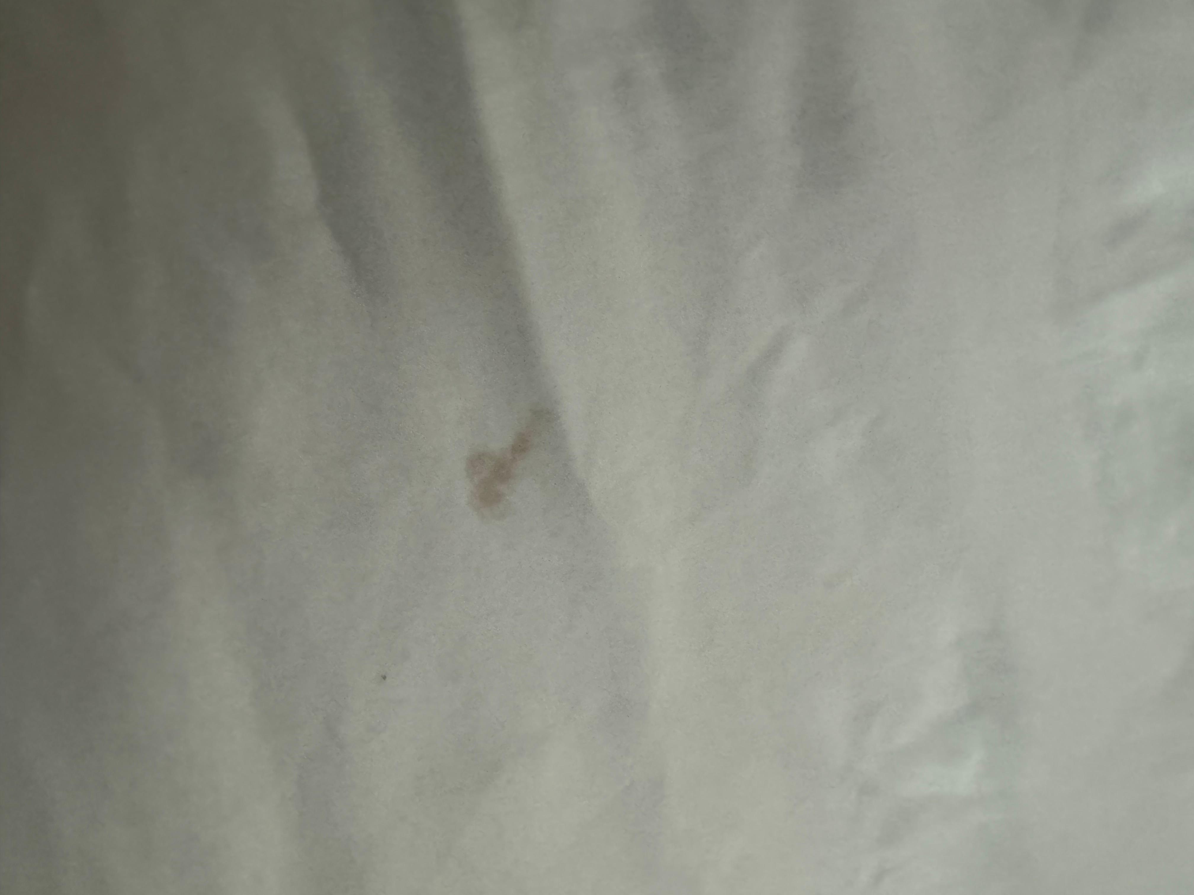 Stains on bedding 