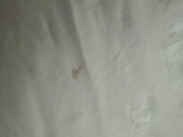 Stains on bedding