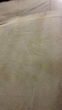 Yellow stain on the bed sheet