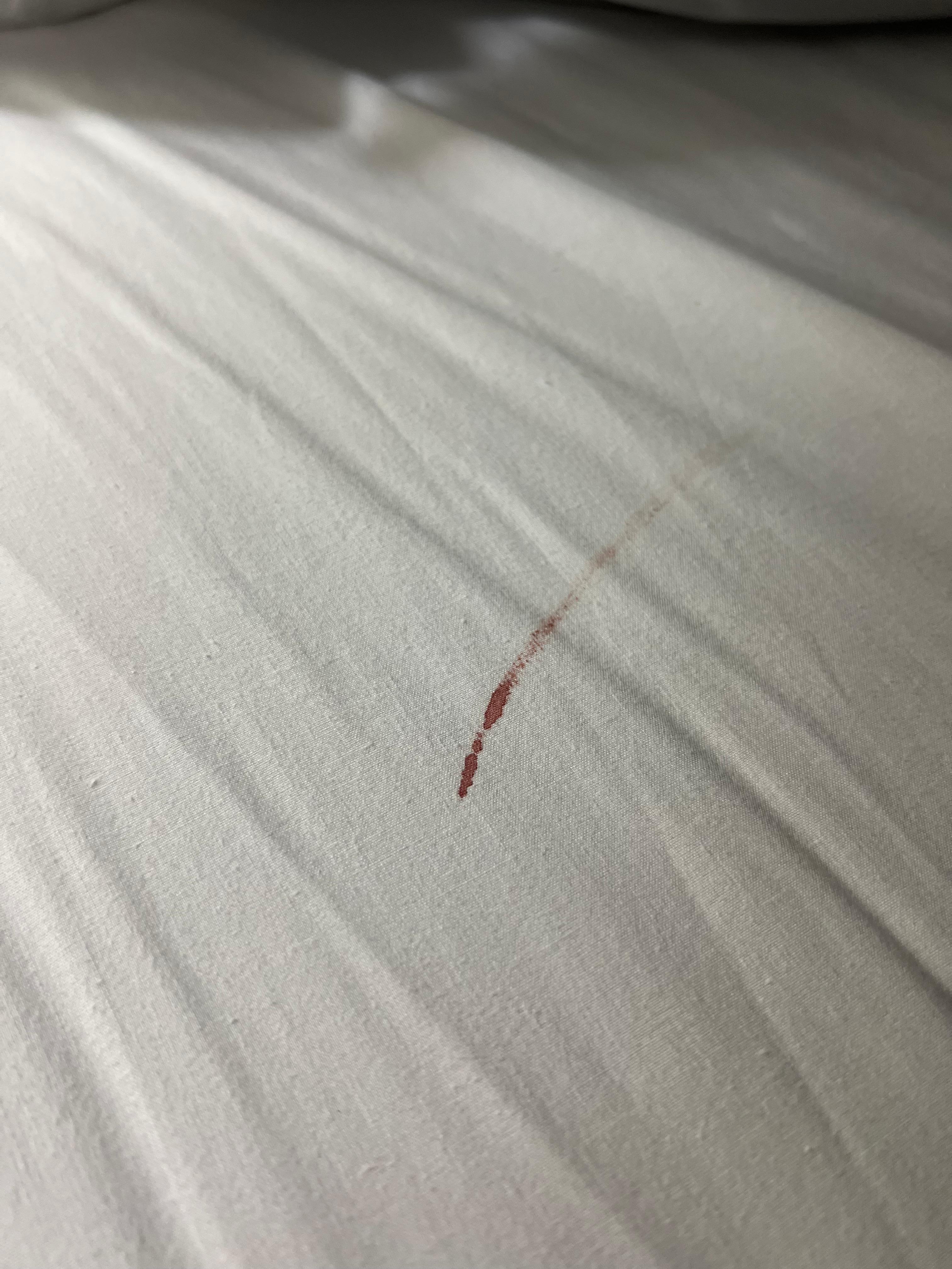 This blood (on the bottom sheet) was right by the pillows. Housekeeping absolutely should have seen it