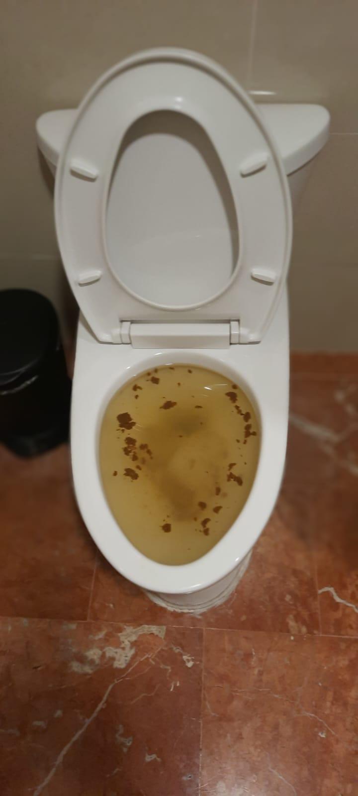 toilets throwing fecal matter outside