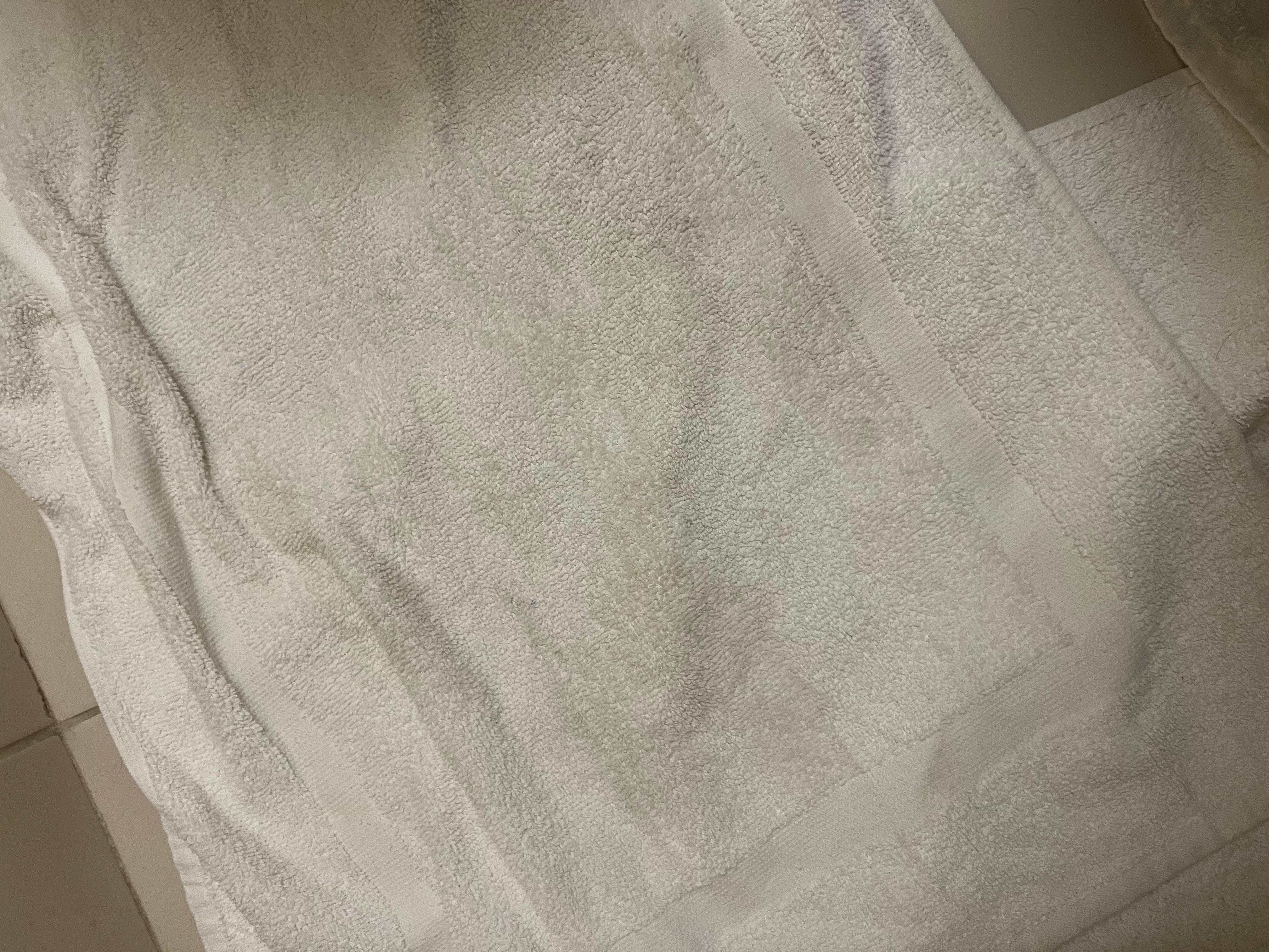 The dirty towels left hanging in the room
