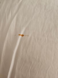 Blood on pillow