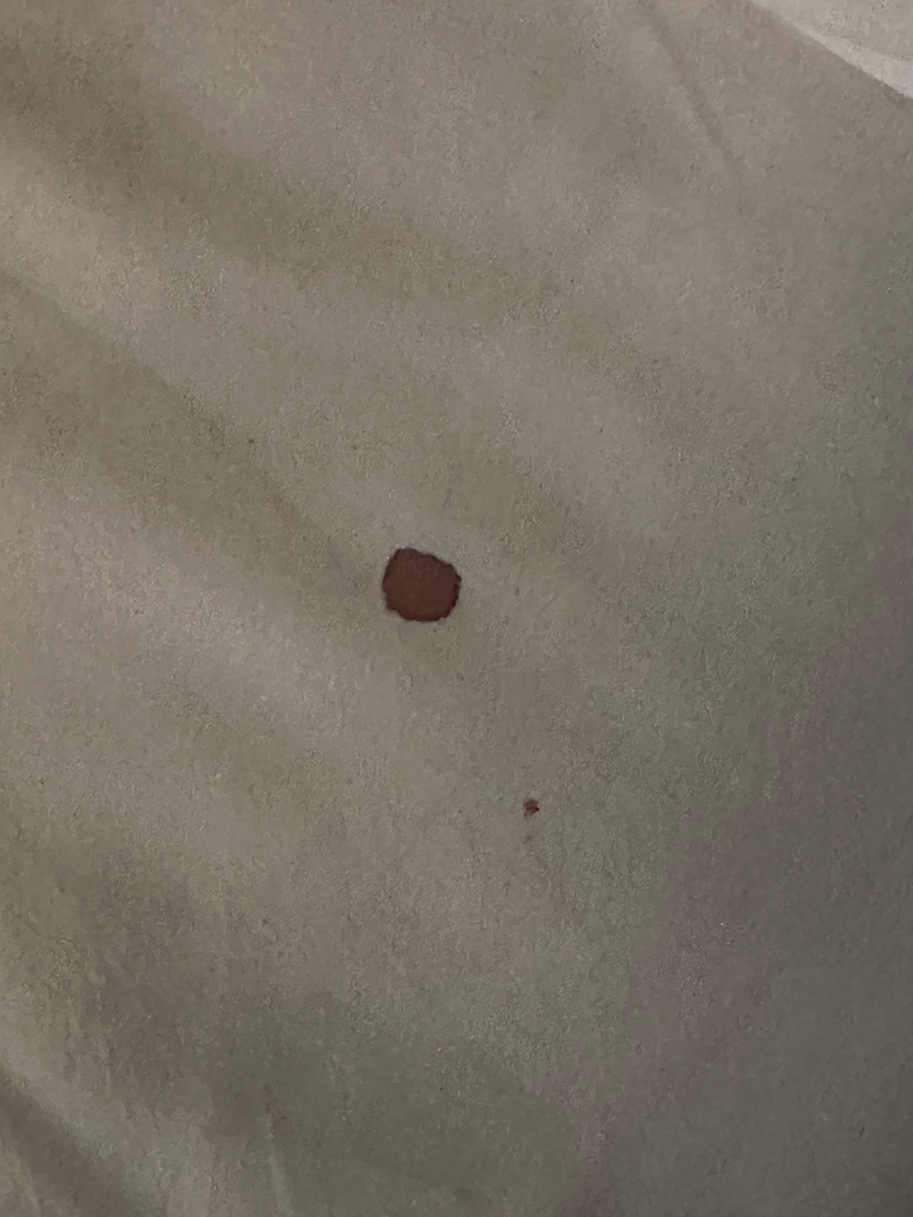 Blood under pillow!!!!  So gross!