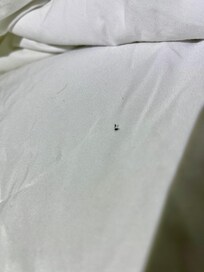 Hairs were on the bed