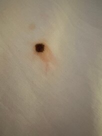 Trace de sang dans les draps à l'ouverture du lit