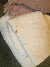 Stain on towel
